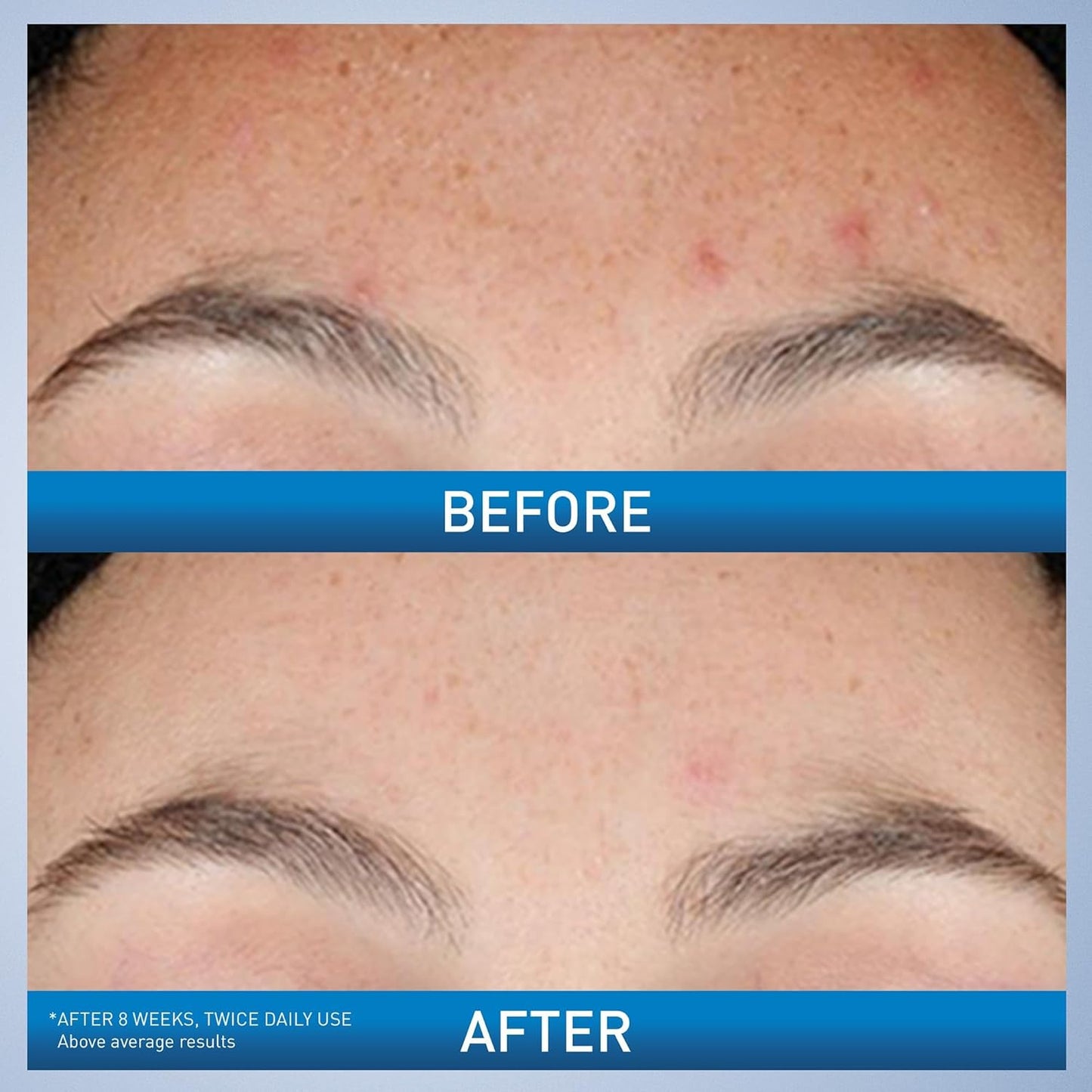 CERAVE Resurfacing Retinol Serum 30 ml